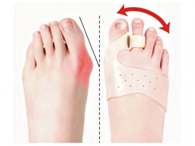 Separator palców na stopie dla hallux valgus z magnesem